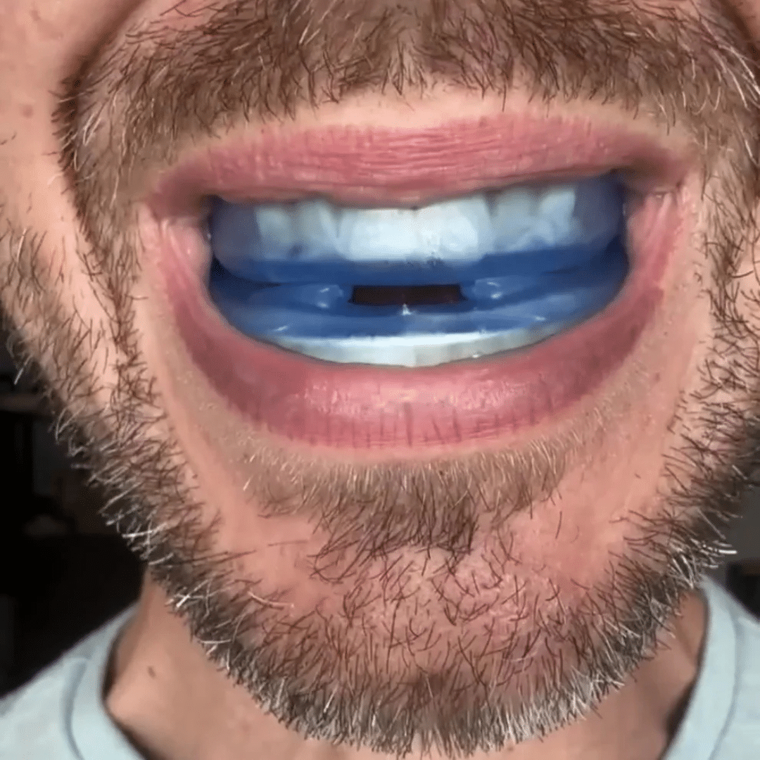 Dormix — Dispositivo Mandibular Anti Ronquidos